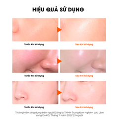 Mặt Nạ Căng Bóng Sur.Medic+ Cung Cấp Multi Vitamin 30g Age Control Multi Vita Mask 30g
