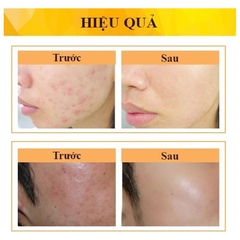 Chấm Mụn Gel Derma Forte