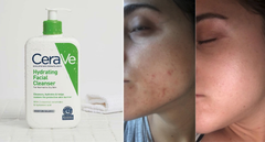 Sữa Rửa Mặt CeraVe Hydrating Facial Cleanser