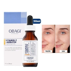 Tinh Chất Sáng Da & Chống Oxy Hóa Obagi Vitamin C + Arbutin Brightening Serum