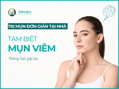 Trị mụn đơn giản tại nhà: Giải pháp cho làn da viêm mụn