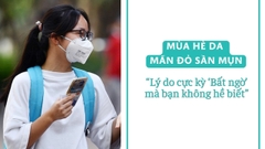 Mùa hè da mẩn đỏ, sần mụn:  Lý do bất ngờ đến từ khẩu trang y tế
