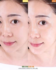 Combo 3 sản phẩm dưỡng trắng Miinskin (Kem chống nắng + kem dưỡng trắng + serum)