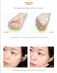 Combo dưỡng trắng da Serum Miinskin 5% Niacinamide + Kem dưỡng trắng nâng tone 70ml