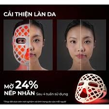 Mặt nạ ánh sáng Halio PureGlow Ultralite Silicone LED Face Mask