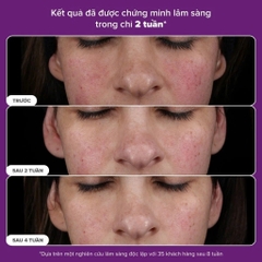Tinh chất ngăn ngừa lão hóa và căng bóng da mặt Paula's Choice PRO Retinaldehyde Treatment 30ml