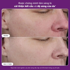 Tinh chất ngăn ngừa lão hóa và căng bóng da mặt Paula's Choice PRO Retinaldehyde Treatment 30ml