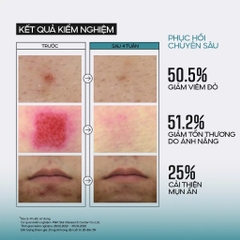 Tinh chất dưỡng da Ốc sên giúp ngăn ngừa lão hóa JUMISO Snail Mucin 95 + Peptide 140ml