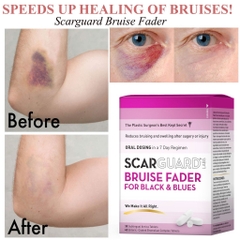 Viên Uống Tan Máu Bầm Scar Guard Labs Bruise Fader For Black & Blue 30 Viên