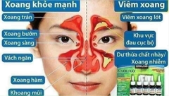 CHAI XỊT MŨI HỖ TRỢ GIẢM VIÊM XOANG VIÊM MŨI DỊ ỨNG KIRKLAND ALLER-FLO (LẺ 1 CHAI) CỦA MỸ