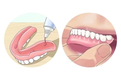 [MẪU MỚI] 1 tuýp Keo dán răng giả Fixodent 68g hàng chính hãng/ Fixodent Denture Adhesive