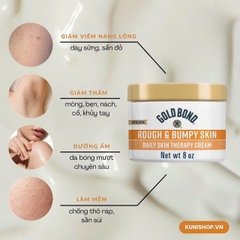 KEM DƯỠNG DÀNH CHO DA SẦN SÙI, VẢY NẾN, VIÊM LỖ CHÂN LÔNG GOLD BOND ROUGH & BUMPY SKIN DAILY SKIN THERAPY CREAM HŨ 226G CỦA MỸ