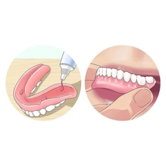 Keo dán hàm răng giả hàm tháo lắp Fixodent 68g, hàng chính hãng/ Fixodent Denture Adhesive