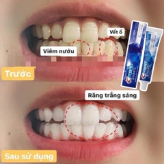 1 tuýp kem đánh răng crest 3d white advanced whitening tuýp 147g crest Mỹ