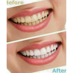 LEVEL 18-28 MIẾNG Crest 3D Whitestrips – Ageless Whitening (Hộp 14 treatments / 28 miếng)