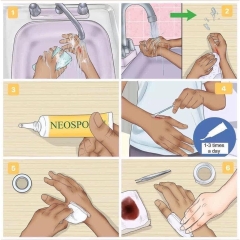 set 3 tuyp Kem mỡ sát khuẩn và giảm sẹo Neosporin Original Oitment