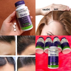 Viên uống hỗ trợ mọc tóc và chống rụng tóc Natrol Biotin Beauty 10,000mcg 100 viên