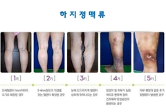 Máy massage xung điện tặng miếng dán điện cực