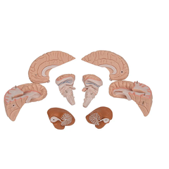 Human Brain Model, 8 part - 3B Scientific