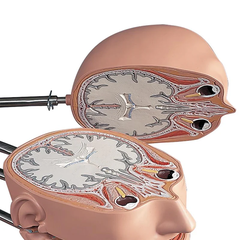 Mô hình thân MRI với 15 mặt cắt ngang - 3B Smart Anatomy