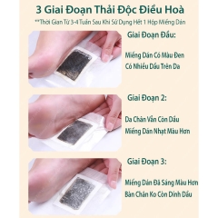 THẢI ĐỘC CHÂN NỘI ĐỊA TRUNG - M261