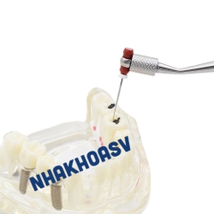 TAY CẦM HỖ TRỢ BÁC SỸ TRONG QUÁ TRÌNH LẤY TỦY