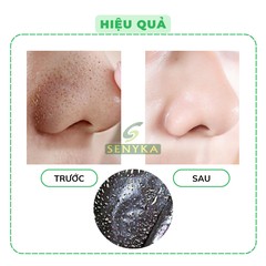 Gel lột mụn đầu đen, mụn cám Black Head giúp làm sạch sâu se khít lỗ chân lông (6g/gói)