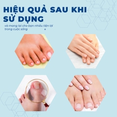 Kềm cắt da móng tay tiện lợi và bộ dụng cụ vệ sinh móng chuyên dụng