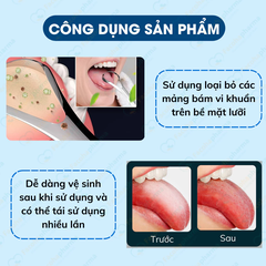 Bộ dụng cụ cạo lưỡi giúp loại bỏ vi khuẩn, mãng bám và hơi thở khó chịu