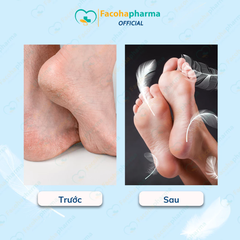 Dụng cụ chà gót chân giúp cạo lớp da chết tiện lợi tại nhà chất liệu thép không gỉ