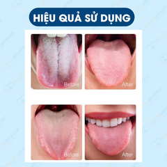 Gel vệ sinh lưỡi giúp thơm miệng và loại bỏ vi khuẩn, mảng bám gây mùi khó chịu