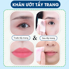 Khăn ướt tẩy trang chiết xuất bơ tươi giúp ngừa mụn, làm sạch sâu