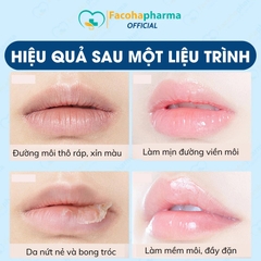 Mặt nạ ngủ cho môi collagen giúp cấp ẩm sâu, giảm thâm, phục hồi da khô nứt