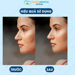 Miếng dán mụn gom cồi trong suốt bảo vệ mụn, che khuyết điểm gói 24 miếng