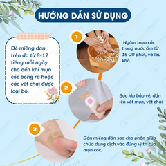 Miếng dán mụn cóc lành tính giúp loại bỏ, ngăn chặn mụn cóc (6 miếng)