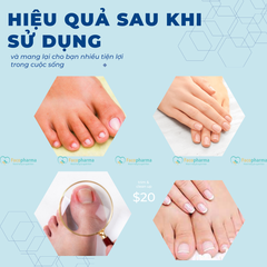 Bộ cắt móng tay 7 món cao cấp chất liệu thép không rỉ bền bỉ