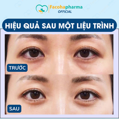 Mặt nạ mắt Collagen bộ 2 miếng dưỡng ẩm làm mờ nếp nhăn cải thiện thâm mắt cấp ẩm giảm bọng mắt