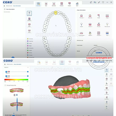 Máy scan trong miệng COXO DL-300P