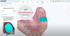 Máy scan trong miệng COXO DL-300P