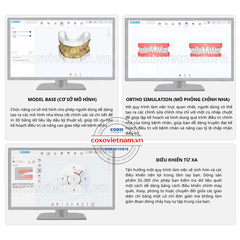 Máy scan trong miệng COXO DL-300P