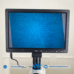 Bộ Camera 16MP Tích Hợp Màn Hình 10.1 Inch CCD-1016M
