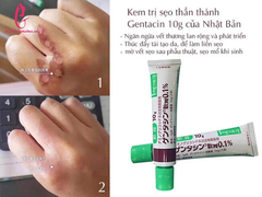 Kem trị sẹo, trị thâm Gentacin Nhật Bản