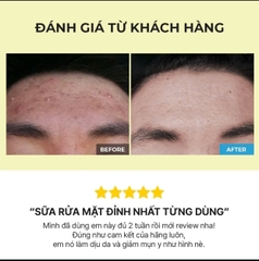 Sữa rửa mặt Cosrx