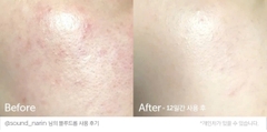 Klairs - Serum Vitamin C 35ml
