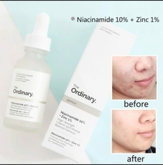 The Ordinary - Serum Niacinamide 10% + Zinc 1%