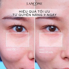 SIÊU HOT - KEM MẮT LANCOME