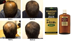 Dầu gội kích thích mọc tóc Kaminomoto Higher Strength – Trị Rụng Tóc Nặng