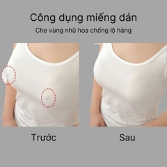 Hộp 5 Cặp Dán Ngực Silicon - Hộp Xanh Lá 15562