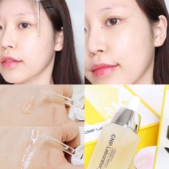 Tinh Chất CNP Laboratory Propolis Energy Active Ampule