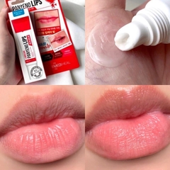 Dưỡng Môi Mediheal Pantenolips 10ml